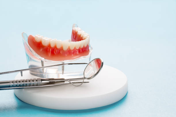 Dental Inlays and Onlays in Theresa, WI